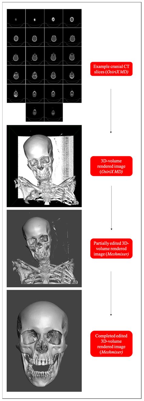 Forensic Sciences Free Full Text Population Inclusive Assigned Sex At Birth Estimation From