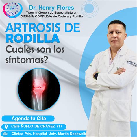 Sintomas De La Artrosis De Rodilla Dr Henry Flores Cirugia Cadera Y