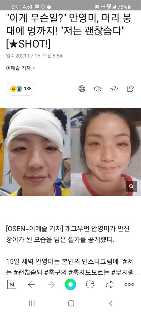 웹진 인벤 : 안영미 얼굴 근황 - 오픈이슈갤러리