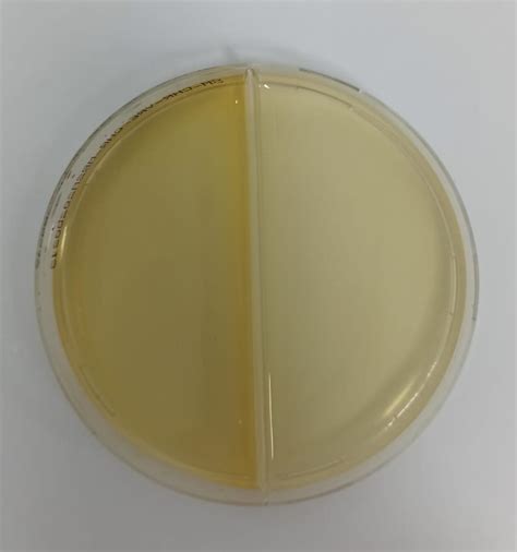 Vancomycin Resistant Enterococcus Chromogenic Agar Chromagar Mrsa Chr