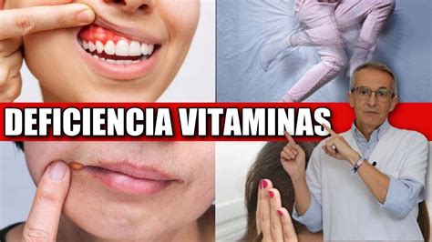 7 SeÑales Frecuentes De Deficiencia De Vitaminas Youtube