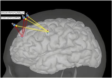 Frontiers Automatic Detection Of Fiducial Landmarks Toward The