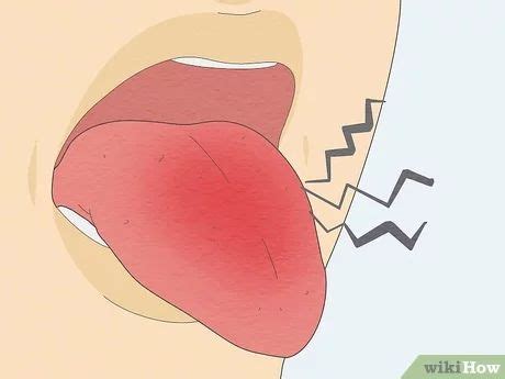 Bumps On Tongue Tongue Sores Sore Tongue Healthy Tongue Tongue