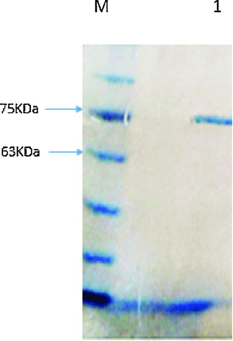 Polyacrylamide Gel Electrophoresis Sds Page Of The Purified Enzyme