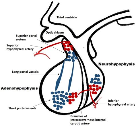 Pituitary Apoplexy Encyclopedia Mdpi