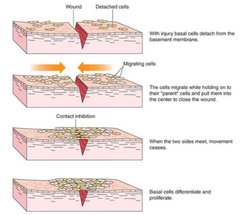 Inflammation And Tissue Repair Flashcards Quizlet