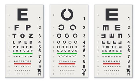 About Visual Function Ashfield Eye Clinic