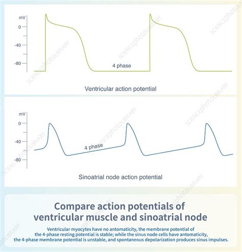 Action Potentials Of Ventricular Muscle And Sinoatrial Node Stock