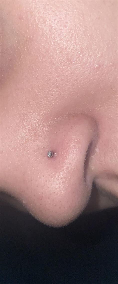 Nose piercing bump? : r/piercing