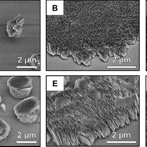 Multi-layered strontium carbonate structures. (A + B + C) Different... | Download Scientific Diagram