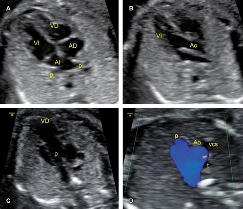 Cardiopat As Cong Nitas Caracter Sticas Y Beneficios Del Diagn Stico