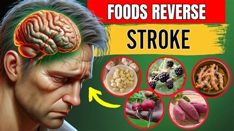 15 Foods To Prevent Stroke And Recover From Stroke Stroke Prevention Not What You Think