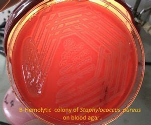 Staphylococcus Aureus Introduction Pathogenecity Lab Diagnosis And