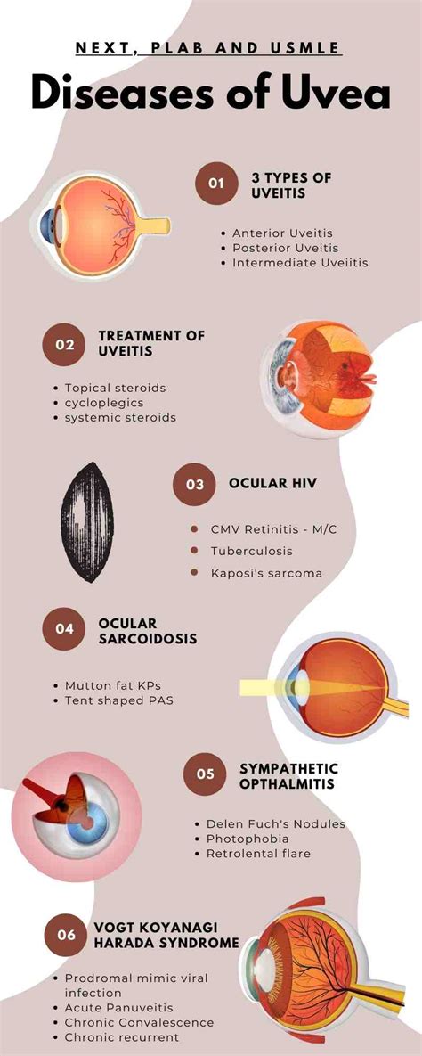 Diseases of Uvea for Medical Students - Free NExT, PLAB and USMLE Notes ...