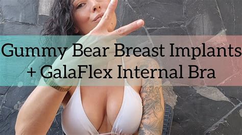 Breast Augmentation Gummy Bear Implants With Galaflex Internal Bra Youtube