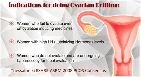 Ovarian Drilling