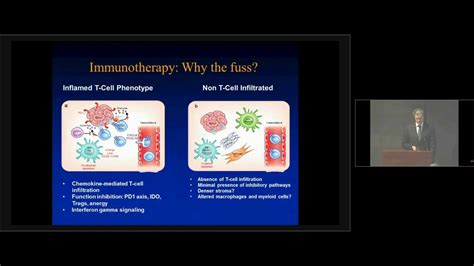 Squamous Cell Lung Cancer Treatment