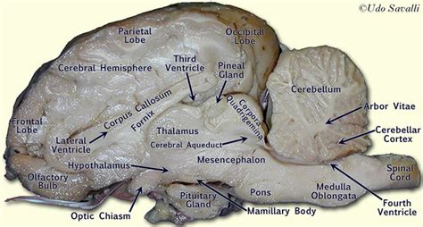 Bio201 Sheep Brain Brain Anatomy Brain Vet Medicine