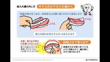 総入れ歯の着脱法 | 口腔ケアチャンネル | 訪問歯科ネット