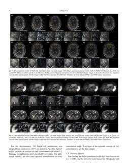 Simultaneous Super Resolution And Motion Artifact Removal In Diffusion