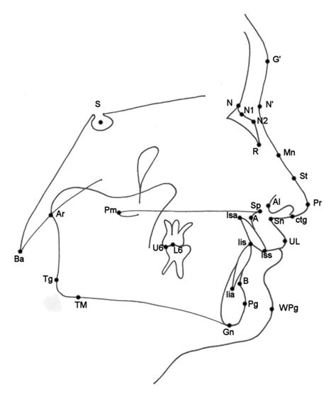 Ijerph Free Full Text Nasal Morphology And Its Correlation To Craniofacial Morphology In