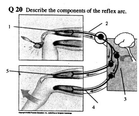 Components Of The Reflex Arc Diagram Quizlet