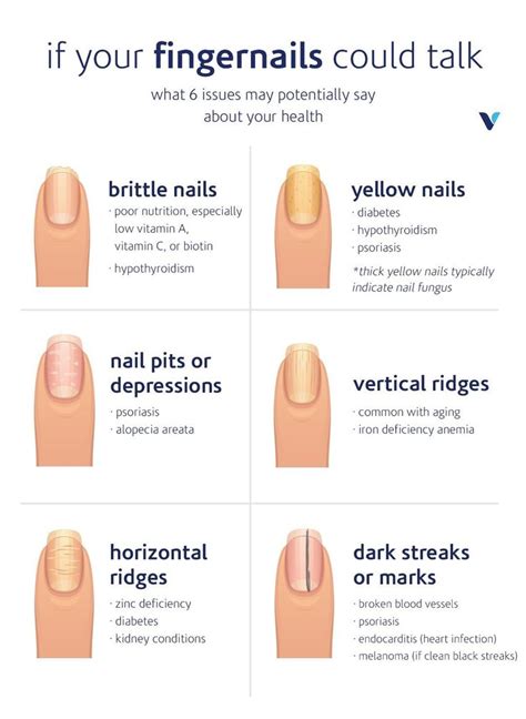 What Your Fingernails Say About Your Health Whats Good By V