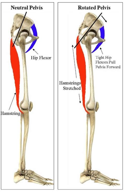 Training To Prevent Hamstring Injuries