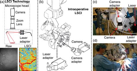 Figure 2 From Intraoperative Laser Speckle Contrast Imaging With