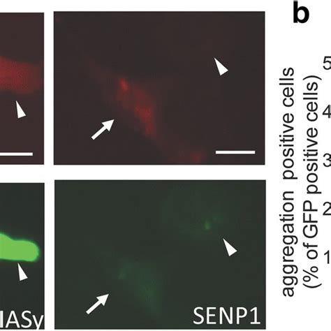 Effect Of Senp Proteins On A T Sod Sumoylation Nsc Cells Were