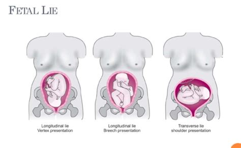 HAPE Exam 3 Pregnancy Flashcards Quizlet