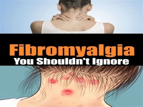 Cfs Fibromyalgia Symptoms Causes Prevalence Diagnosis Part 2