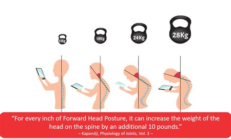 Which Posture Are You Physiomed