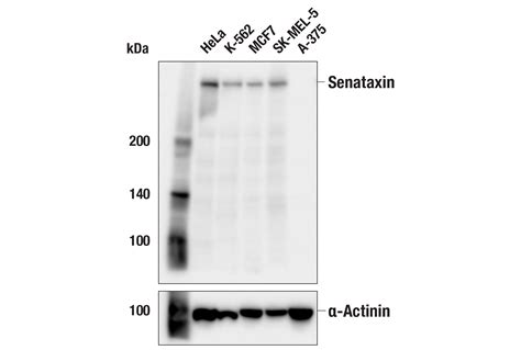 Senataxin E9Z9F Rabbit MAb Cell Signaling Technology