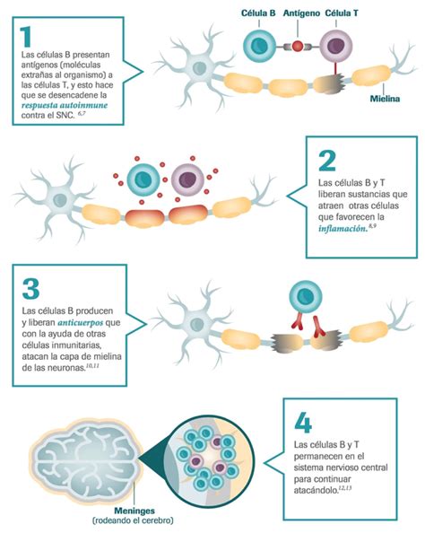 El Importante Papel Que Tienen Las Células B En La Esclerosis Múltiple Roche Cerca Tuyo