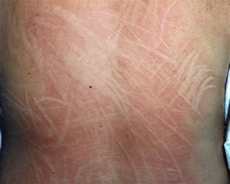 Skin Writing - MEDizzy Journal