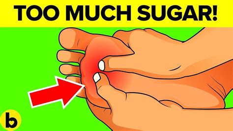 Warning Signs That You Are Eating Too Much Sugar Youtube