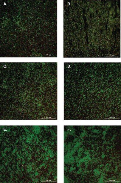 Fluorescently Stained In Situ Bacteria Colonies Are Inhibited As