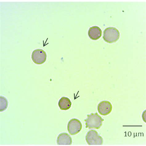 Blood Smear From Hippocamelus Antisensis The Arrows Point Out