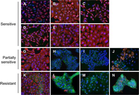 E Cadherin And Vimentin Expression And Subcellular Localization Merged