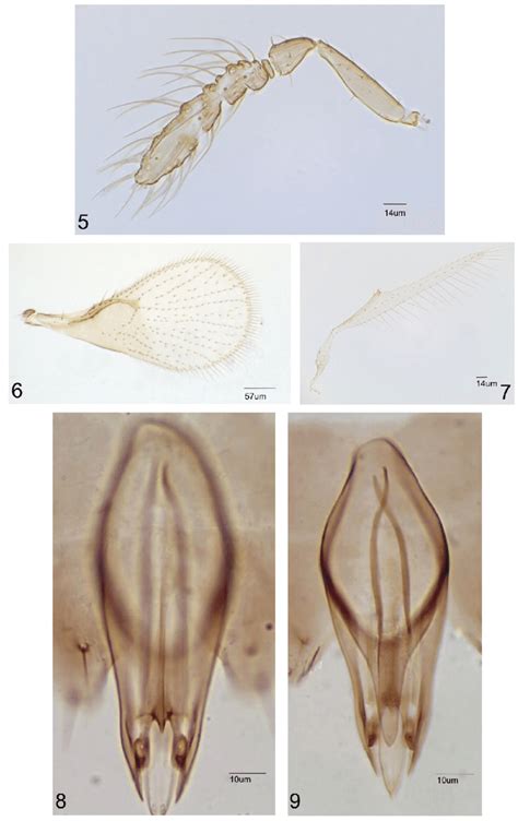 Trichogramma Valmiri Sp Nov Male 5 Antenna 6 Forewing 7 Download Scientific Diagram