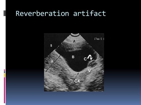 Introduction To Sonography Ppt Download