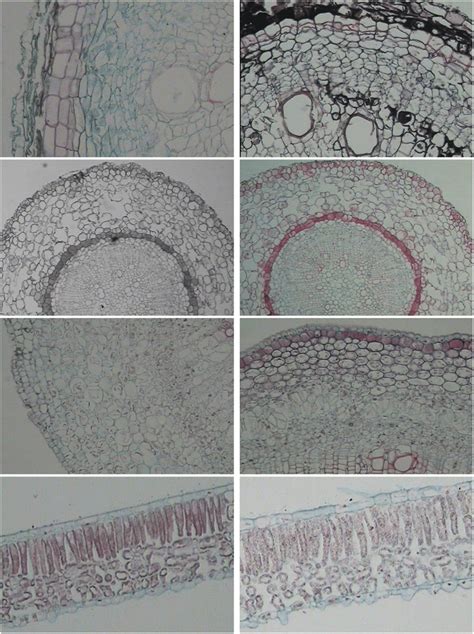 Transverse Sections Of Lateral Root Adventitious Root Stem And Leaf