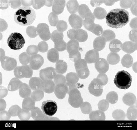 Light Micrograph Of A Normal Human Blood Smear Showing The Five Types