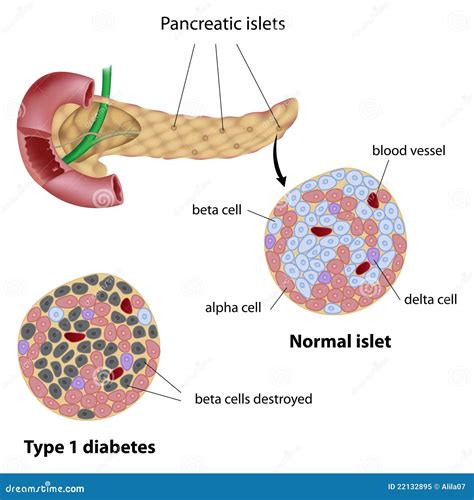 Pancreatic Islet Stock Vector Illustration Of Beta Diabetes 22132895