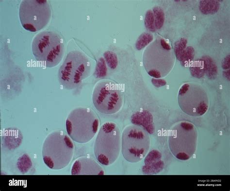 Conjunto De Cromosomas Humanos Fotograf As E Im Genes De Alta