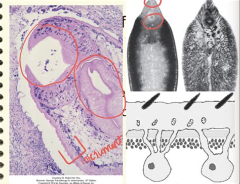 Parasitology Platyhelminthes Flashcards Quizlet