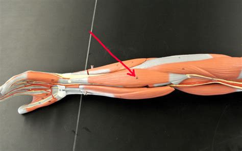 Combo With Muscles That Move The Wrist Hand And Fingers And 1 Other