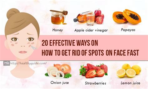 how to get rid of spots fast at home