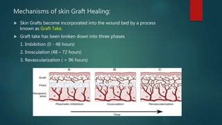 Concepts of Skin Grafts and skin substitutes.pptx